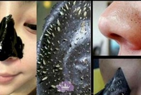 Как быстро убрать черные точки на носу - ликбез для новичков