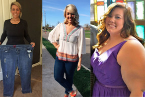 Откровения 160-килограммовой толстушки, похудевшей после шунтирования желудка на 73 кг