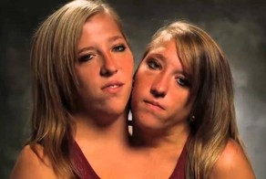 15 интересных фактов о сиамских близняшках Хенсел