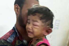 У четырехлетней девочки врачи извлекли из уха 80 личинок