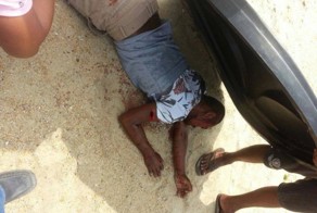 В Малайзии мужчину порубили мачете, но он остался жив