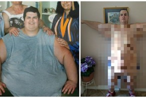 Мужчина весом более 320 кг сумел похудеть. Но повисла огромная проблема!