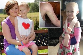 Врачи вылечили девочку от рака (9 фото)