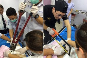 Таец сумел расстаться с секс-игрушкой лишь с помощью врачей и ножовки