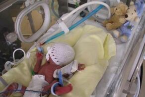 Маленький мальчик с ужасным лицом