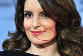 15 знаменитостей с физическими недостатками