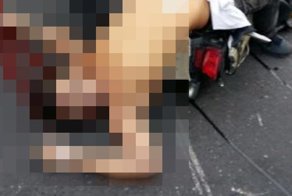 Мотоциклист погиб из-за бездомной собаки