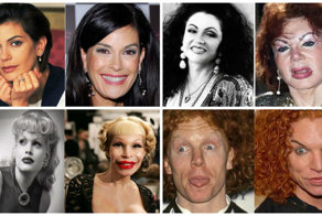 Пластический экстрим - особенный вид спорта