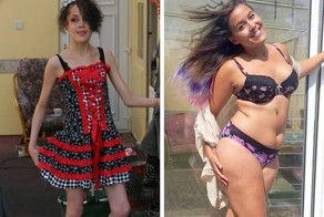 Бывшая анорексичка гордится новообретенными складками на животе