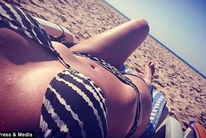 Девушка с витилиго благодаря Instagram обрела новую жизнь