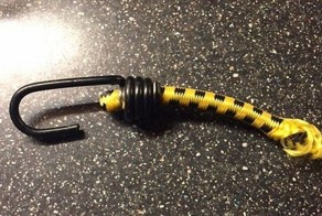 Металлический крюк попал в глаз мужчине