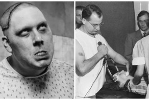 Лоботомия: немного истории и страшных фотографий