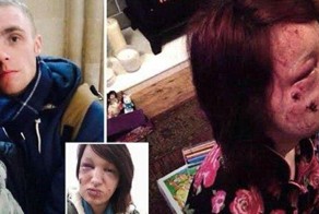 Ревнивый парень покусал лицо подруги, чтобы ни один мужик больше на нее не посмотрел