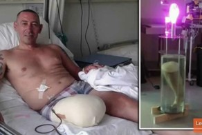 15 человек, которые пережили ужасные атаки акул