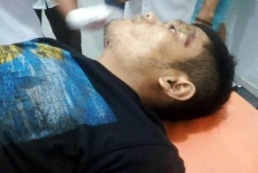 Мотоциклист получил ужасную травму и скончался