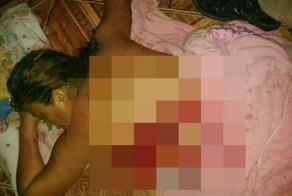 Женщина упала с унитаза и погибла