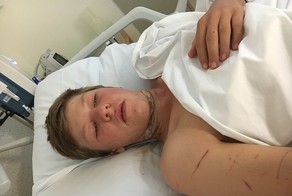 Наушники Apple чуть не лишили подростка головы