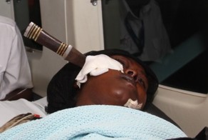 Мужчина воткнул нож в лицо жене