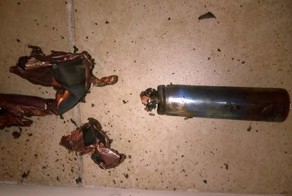 Электронная сигарета лишила парня зубов