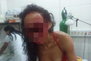 Мачете в лицо девушке