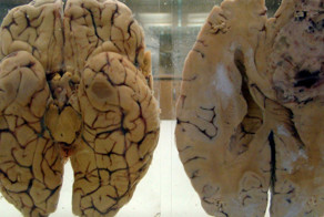 Чем заняться сегодня, если завтра умирать?