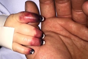 Родители думали, что у малыша просто болят ушки. После диагностики врачи запаниковали