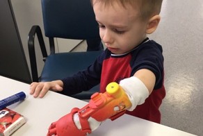 Впервые в России ребенку установили 3D-печатный протез