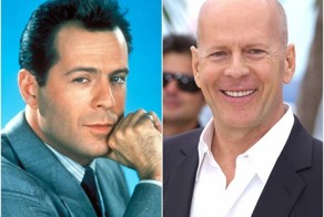 Как выглядели знаменитые лысые актеры до того, как потеряли свои волосы