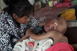 Родители мальчика против операции по удалению огромной раковой опухоли