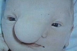 В детстве родная мать назвала его уродом. Вот что он понял годы спустя…