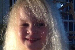 5-летняя девочка с редкой врожденной аномалией, которая роднит ее с Эйнштейном