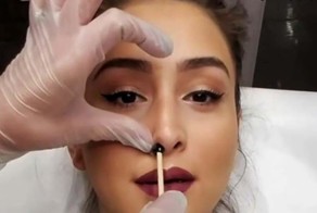 Вырывать волосы из носа — это не очень хорошая затея!