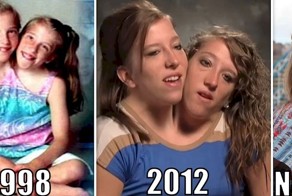 Как сложилась жизнь известных сиамских близнецов Эбби и Бриттани Хензель