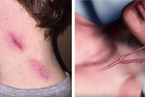 Молодой парень скончался после интимных отношений со своей подругой