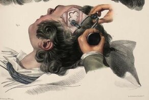 Шокирующие иллюстрации из руководства по хирургии XIX века