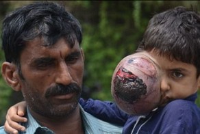 Боксер Амир Хан оплатит лечение 7-летнего мальчика