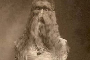 Жуткие фотоснимки цирковых знаменитостей