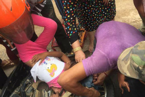 Волосы маленькой девочки попали в колесо мотоцикла