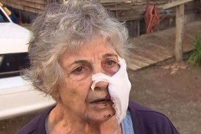 80-летняя женщина пострадала от нападения рыси