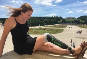 «Нога-меловая доска»: Эта путешественница подписала фото с помощью собственного протеза