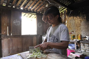 Из-за огромного нароста на голове, парня окрестили "осьминогом"