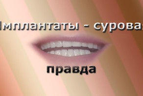 Они хотели вырвать мне все зубы!