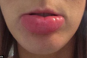 Британию поразило нашествие слепней