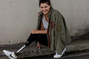 Девушка с искусственной ногой готовится к марафону