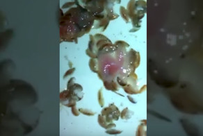 В Австралии странные крошечные морские вампиры атаковали ноги подростка