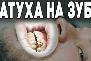 Татуировка на зубе. Впервые в России. Чо как и сколько стоит