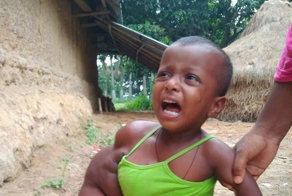 Огромная рука маленькой девочки требует срочного лечения