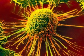 Новая технология распознает рак за 10 секунд