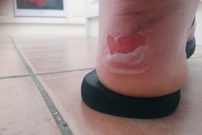 При взгляде на эти снимки каждая девушка вскрикнет от ужаса!