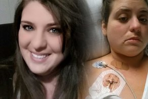 Женщина попала в реанимацию из-за укуса маленького паучка